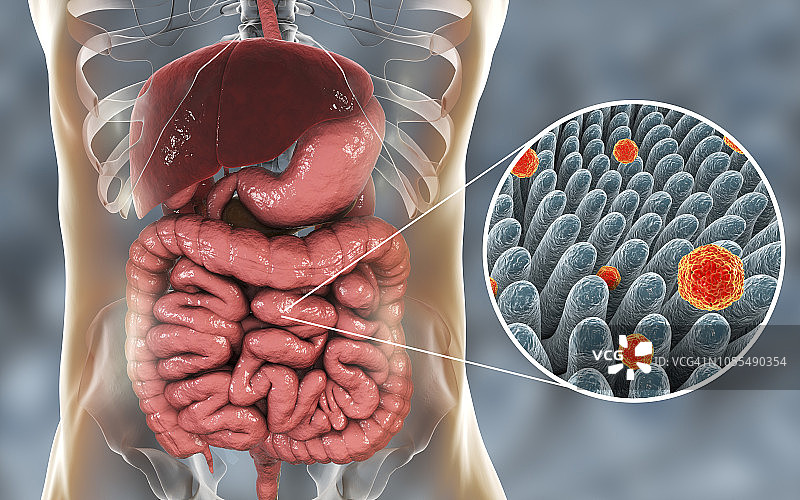 肠道内的甲型肝炎病毒图片素材