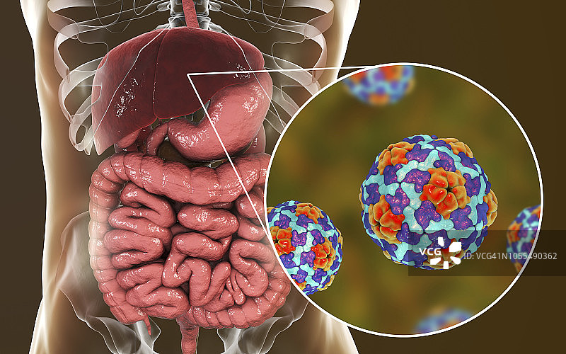甲型肝炎感染插图图片素材
