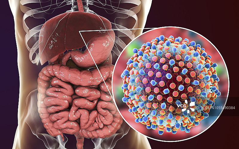 丙型肝炎感染插图图片素材