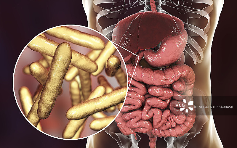 惠普尔病，图示图片素材