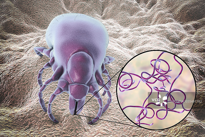 莱姆病蜱虫插图图片素材