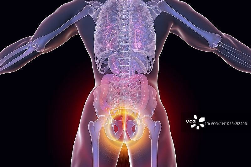 痔疮插图图片素材