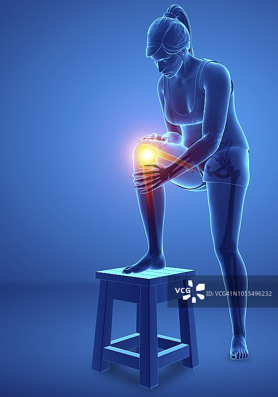 膝盖疼痛的女人，插画图片素材