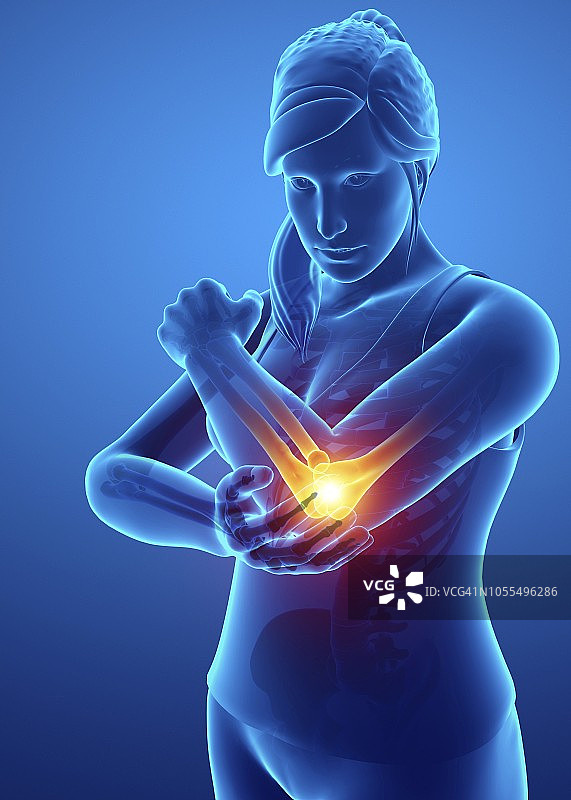 肘部疼痛的女人，插图图片素材