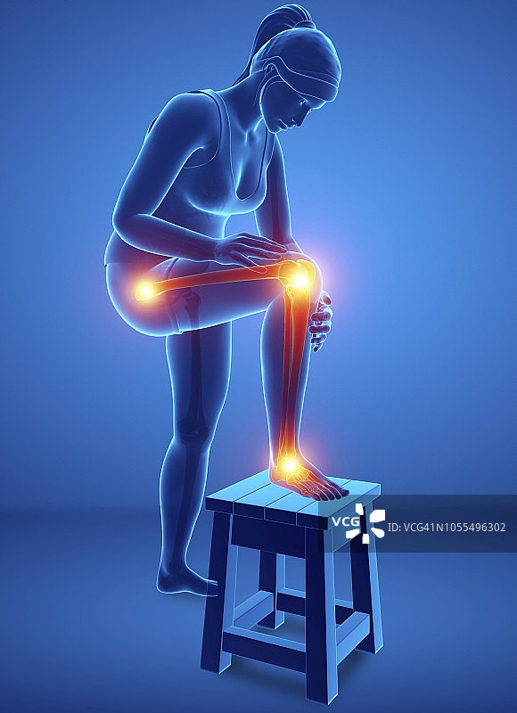 腿痛的女人，插图图片素材