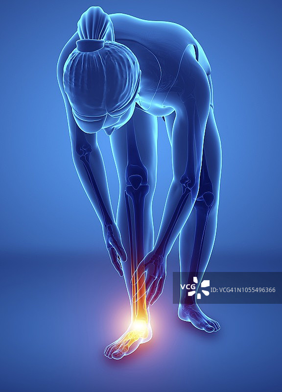 脚痛的女人，插图图片素材