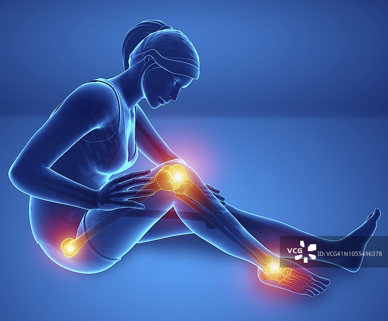 腿痛的女人，插图图片素材