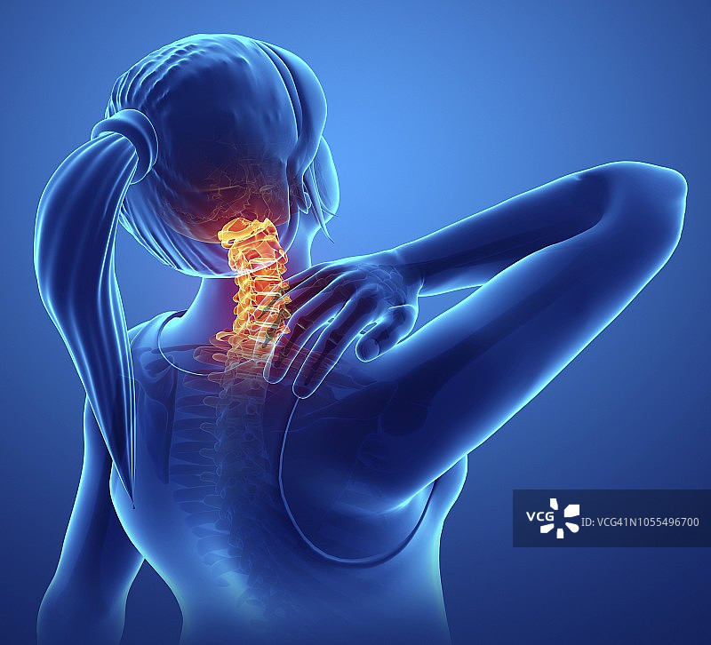 颈部疼痛的女人，插图图片素材