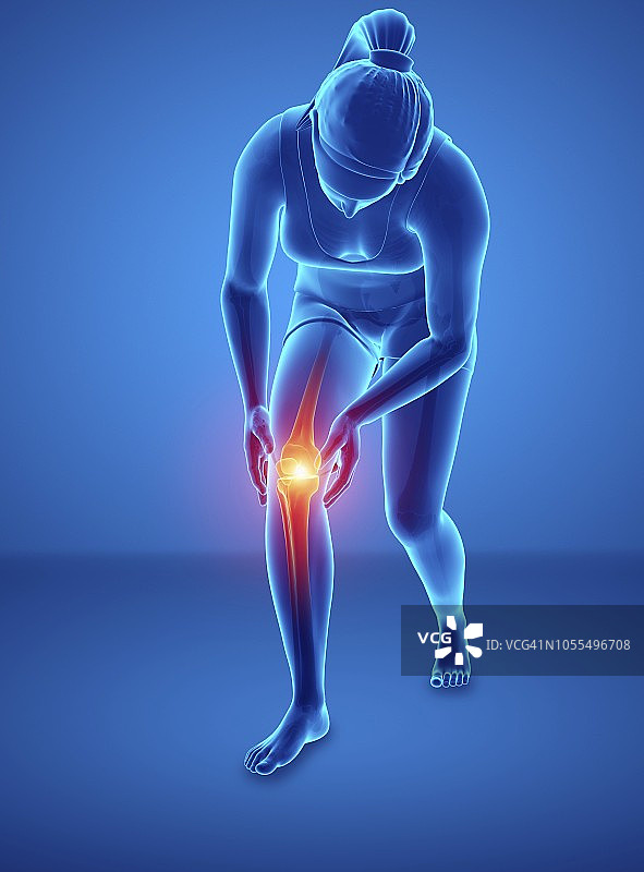 膝盖疼痛的女人，插画图片素材