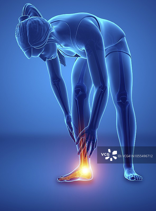 脚痛的女人，插图图片素材