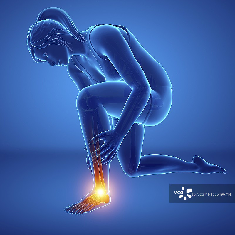 脚痛的女人，插图图片素材