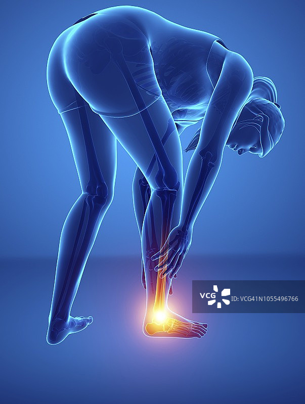 脚痛的女人，插图图片素材