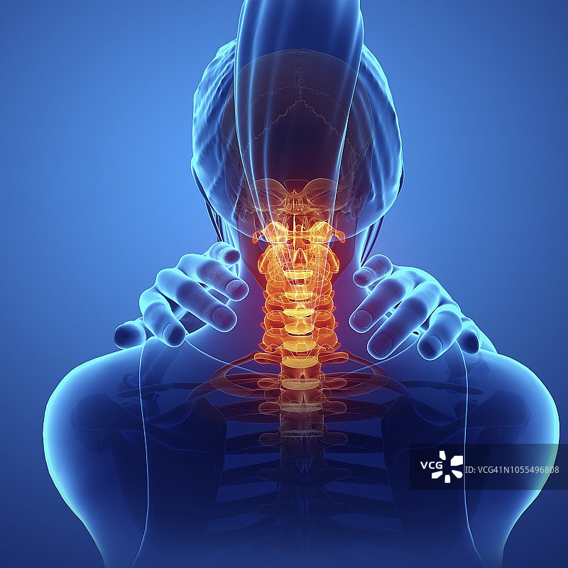 颈部疼痛的女人，插图图片素材