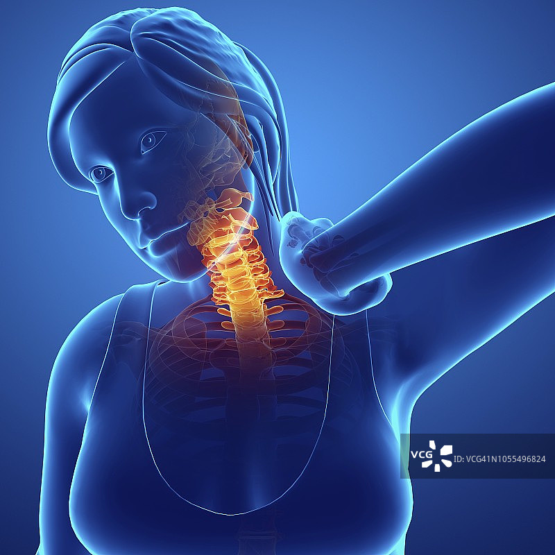 颈部疼痛的女人，插图图片素材