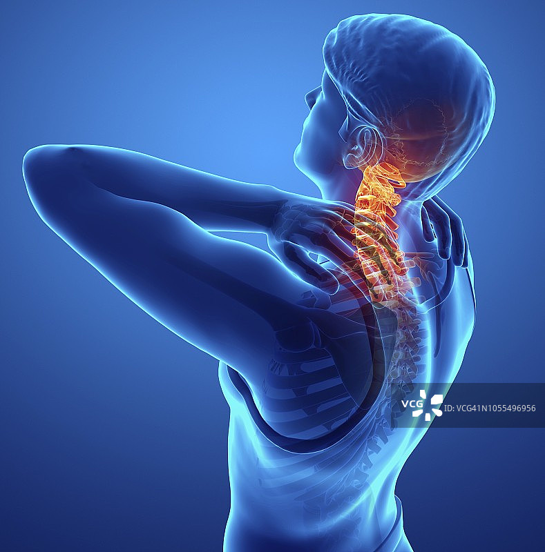 颈部疼痛的男人插图图片素材