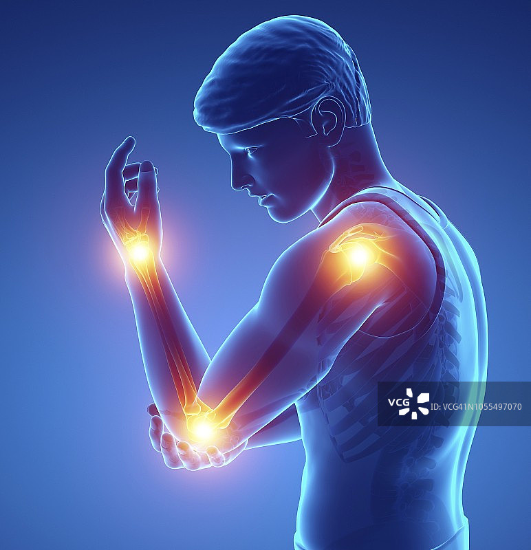 手臂疼痛的男人，插图图片素材