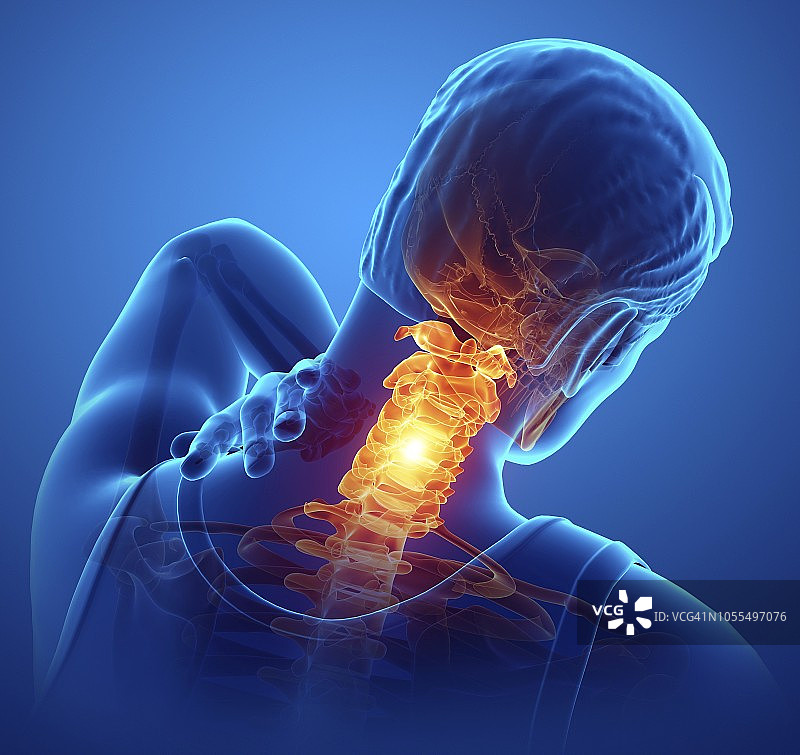 颈部疼痛的男人插图图片素材