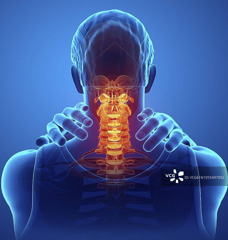 颈部疼痛的男人插图图片素材