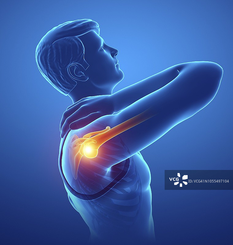 肩部疼痛的男人插画图片素材