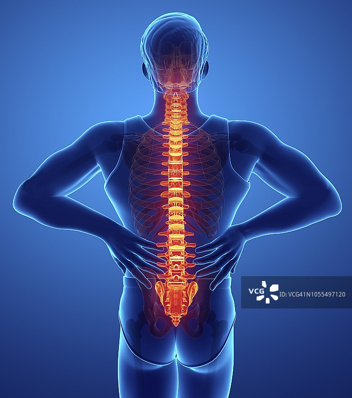 背痛的男人，插图图片素材