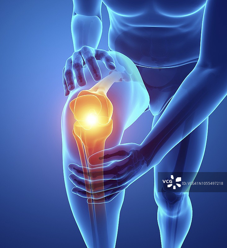 膝盖痛的人，插图图片素材