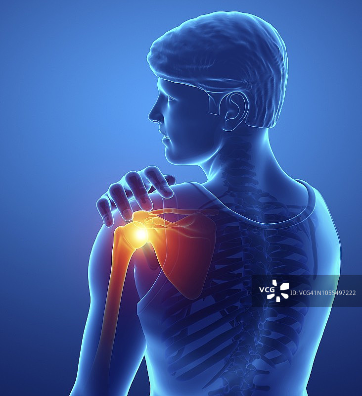 肩部疼痛的男人插画图片素材