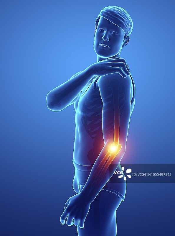 肘部疼痛的男人，插图图片素材