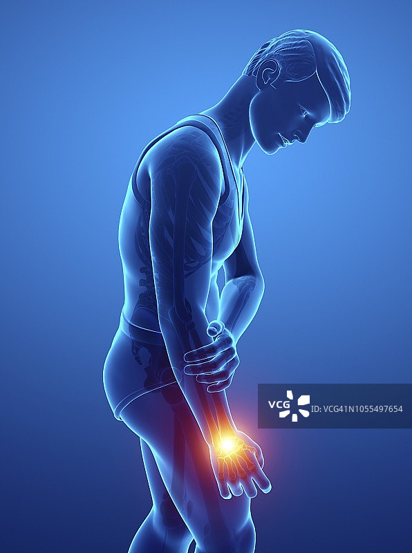 手腕疼痛的男人，插图图片素材