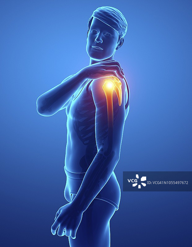 肩部疼痛的男人插画图片素材