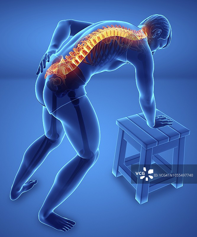 背痛的男人，插图图片素材