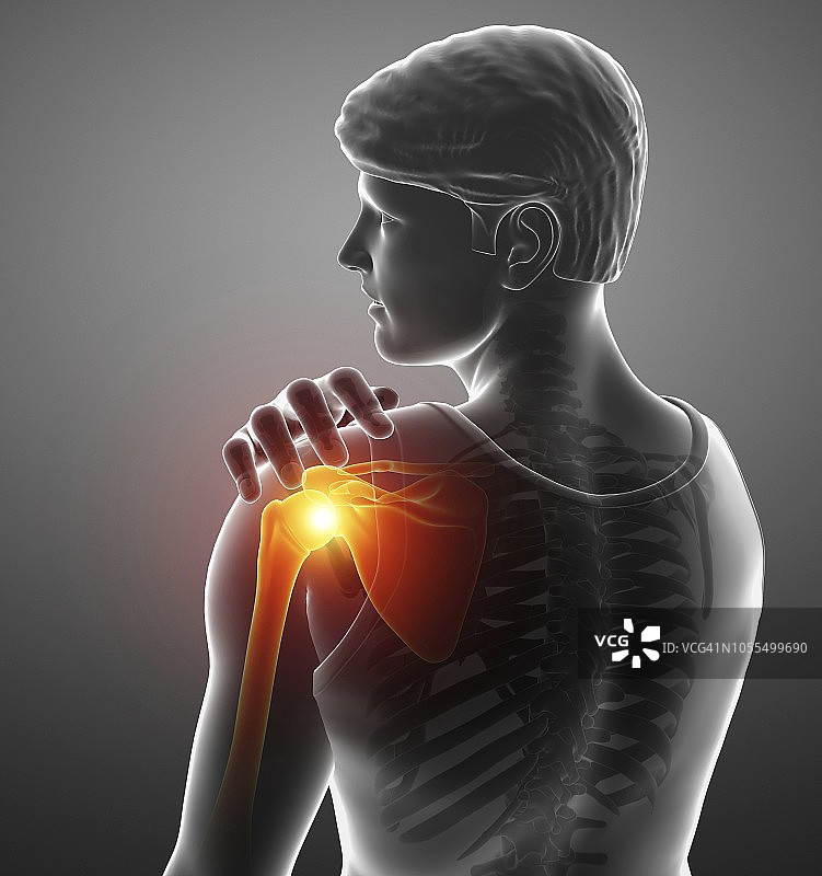 肩部疼痛的男人插画图片素材