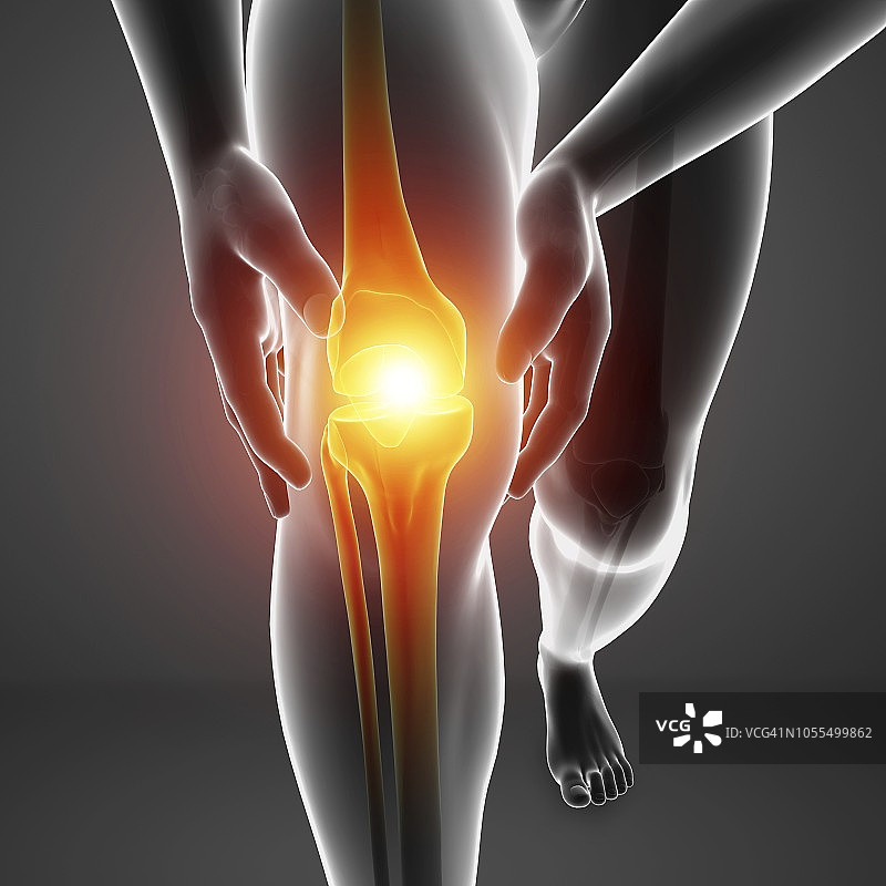 膝盖痛的人，插图图片素材