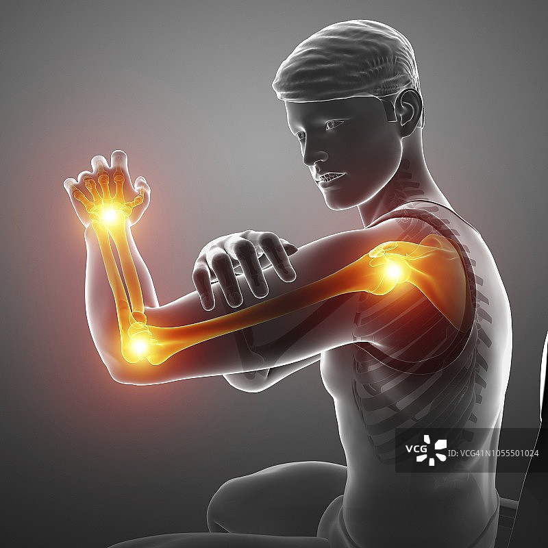 手臂疼痛的男人，插图图片素材