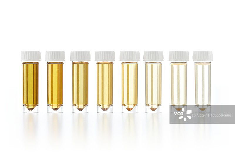 用于分析的尿液样本图片素材