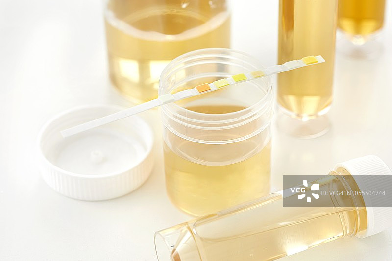 尿液样本分析与试纸图片素材