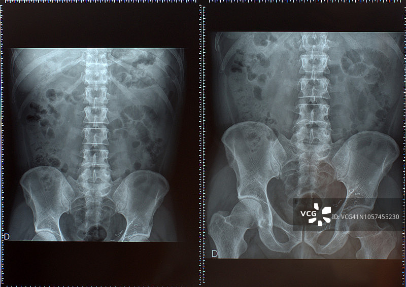 腹部放射学图片素材