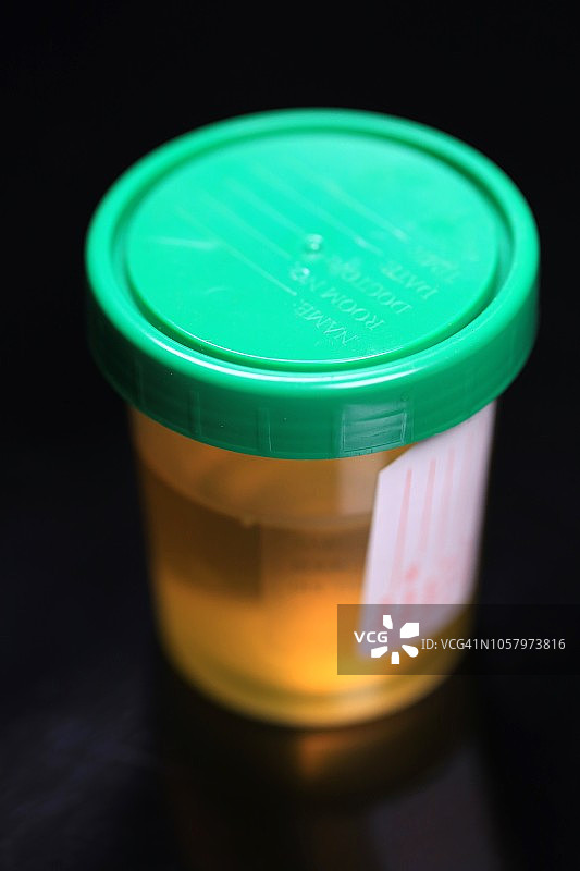 诊所毒品检测样本瓶图片素材