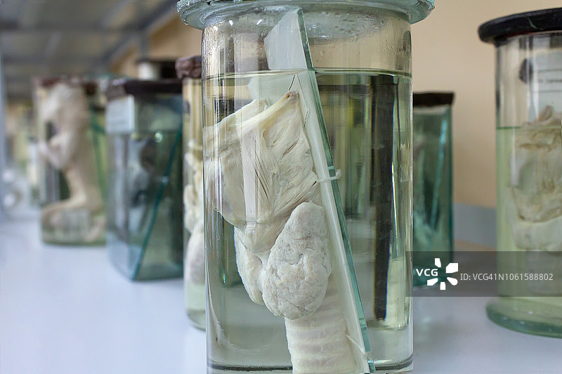 人体解剖：人体湿体标本，医学图片素材