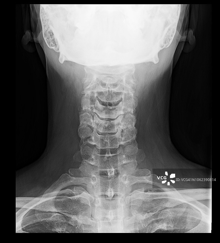 颈部X光片图片素材