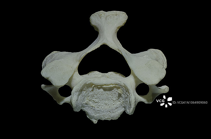 第四颈椎C4图片素材