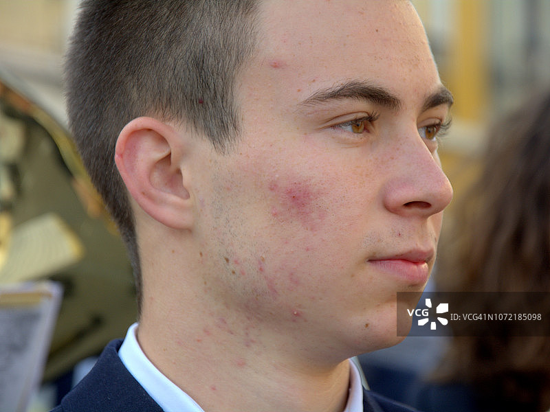长粉刺的青少年音乐家图片素材