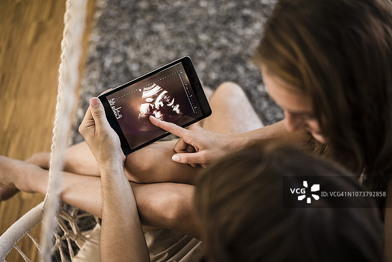 情侣在平板电脑上看超声波扫描图片素材