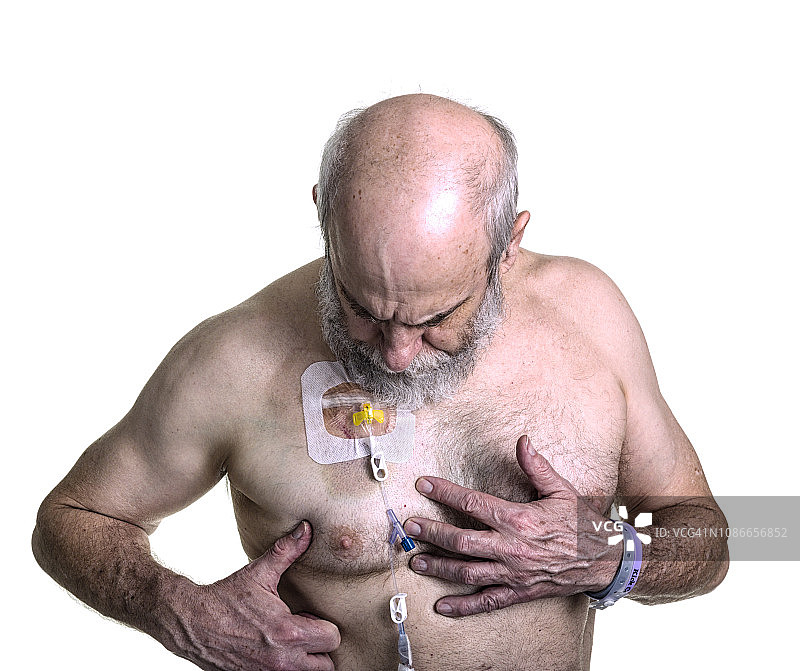 化疗患者检查静脉胸腔输液港图片素材