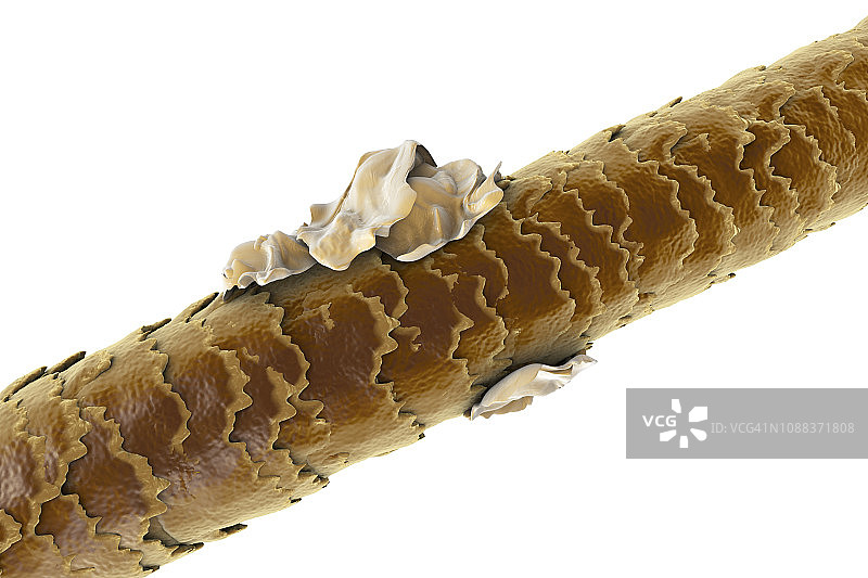 有头皮屑的人类头发插图图片素材