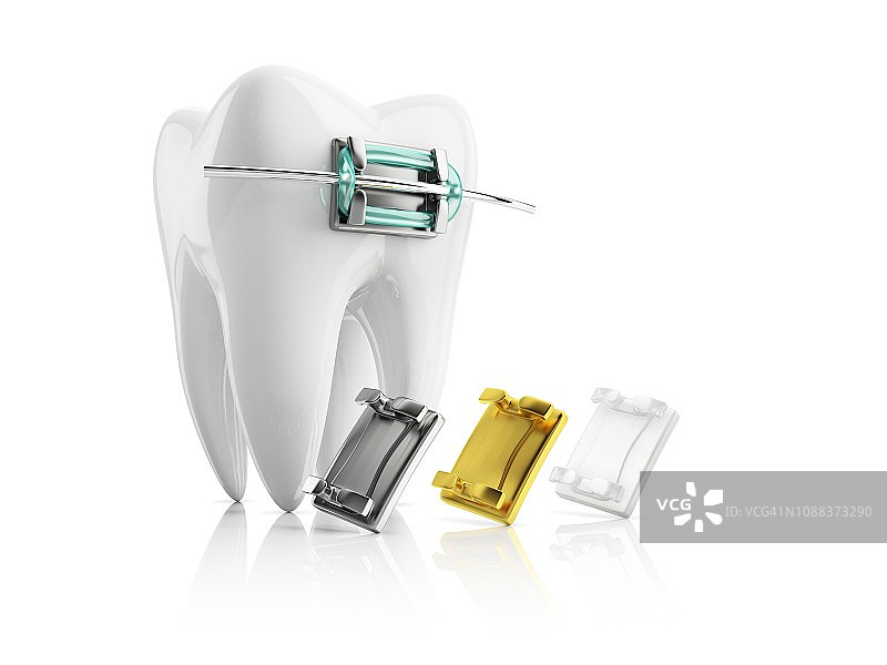 带牙套的牙齿插画图片素材