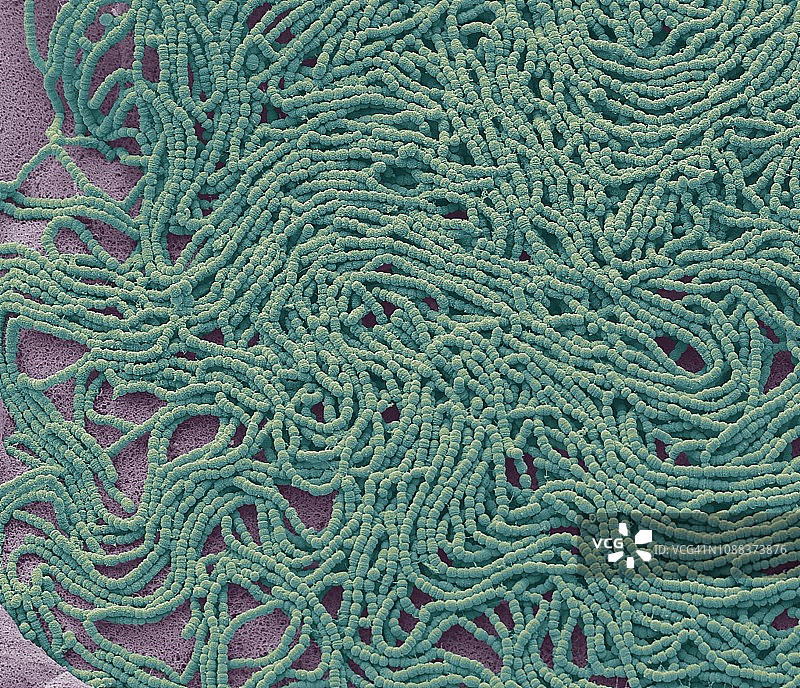 痰培养，扫描电子显微镜图片素材