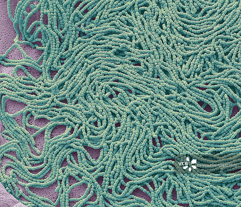 痰培养，扫描电子显微镜图片素材