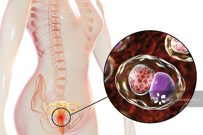 衣原体感染插图图片素材
