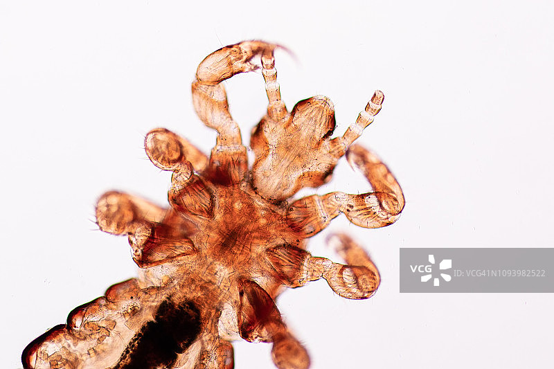 头虱（人头虱），一种寄生虫，以吸食血液为食图片素材