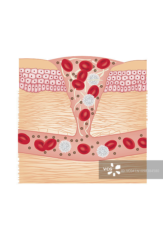 显示血液凝结的剖面图，皮肤愈合过程图片素材